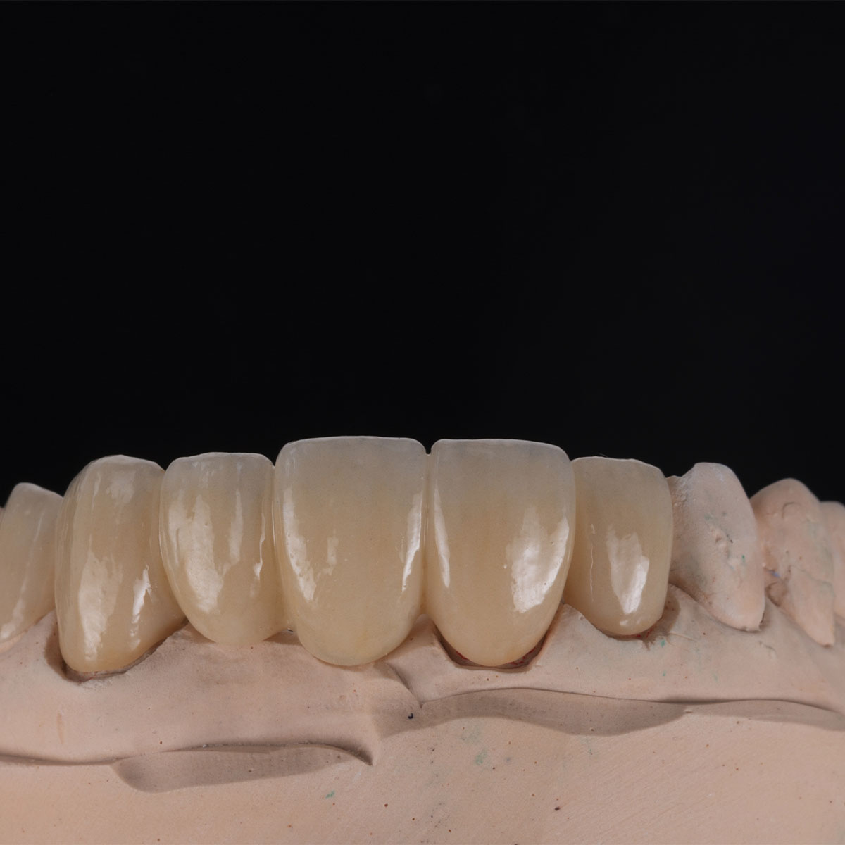 Biomimetic Dentistry Biomimetic Dentistry